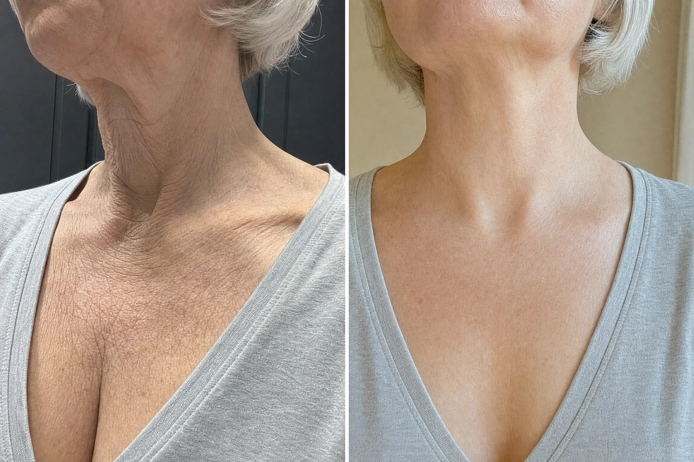 Close-up neck comparison